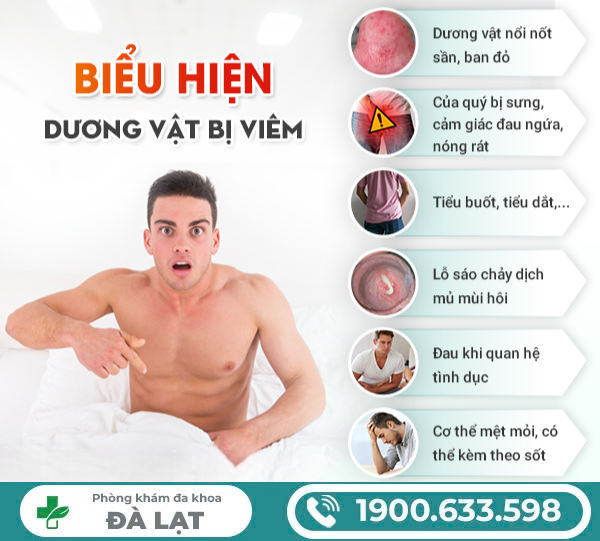 Hình ảnh minh họa